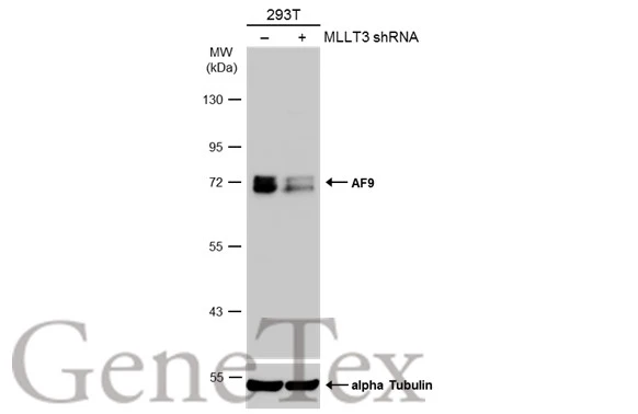 Non-transfected (–) and transfected (+) 293T whole cell extracts (50 μg) were separated by 7.5% SDS-PAGE, and the membrane was blotted with AF9 antibody (GTX102835) diluted at 1:500. The HRP-conjugated anti-rabbit IgG antibody (GTX213110-01) was used to detect the primary antibody, and the signal was developed with Trident ECL plus-Enhanced.