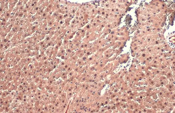 AF9 antibody detects AF9 protein at cytoplasm and nucleus by immunohistochemical analysis. Sample: Paraffin-embedded mouse liver. AF9 stained by AF9 antibody (GTX102835) diluted at 1:500. Antigen Retrieval: Citrate buffer, pH 6.0, 15 min
