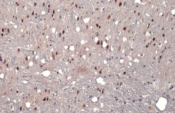 AF9 antibody detects AF9 protein at nucleus by immunohistochemical analysis. Sample: Paraffin-embedded mouse brain. AF9 stained by AF9 antibody (GTX102835) diluted at 1:1500. Antigen Retrieval: Citrate buffer, pH 6.0, 15 min