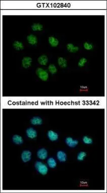 XPC antibody [C2C3], C-term