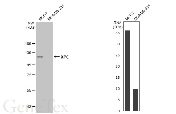 Various whole cell extracts (30 μg) were separated by 7.5% SDS-PAGE, and the membrane was blotted with XPC antibody [C2C3], C-term (GTX102840) diluted at 1:1000. The HRP-conjugated anti-rabbit IgG antibody (GTX213110-01) was used to detect the primary antibody. Corresponding RNA expression data for the same cell lines are based on Human Protein Atlas program.