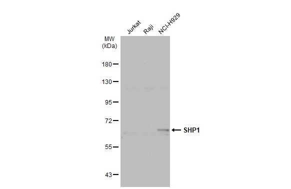 Various whole cell extracts (30 ug) were separated by 7.5% SDS-PAGE,and the membrane was blotted with SHP1 antibody (GTX102864) diluted at 1:1000. The HRP-conjugated anti-rabbit IgG antibody (GTX213110-01) was used to detect the primary antibody.