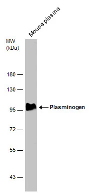 Mouse tissue extract (50 μg) was separated by 7.5% SDS-PAGE, and the membrane was blotted with Plasminogen antibody (GTX102877) diluted at 1:500. The HRP-conjugated anti-rabbit IgG antibody (GTX213110-01) was used to detect the primary antibody.