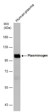 Human tissue extract (30 μg) was separated by 7.5% SDS-PAGE, and the membrane was blotted with Plasminogen antibody (GTX102877) diluted at 1:2000. The HRP-conjugated anti-rabbit IgG antibody (GTX213110-01) was used to detect the primary antibody.