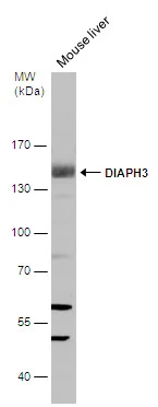 Mouse tissue extract (50 μg) was separated by 7.5% SDS-PAGE, and the membrane was blotted with DIAPH3 antibody [C1C3] (GTX102892) diluted at 1:500.