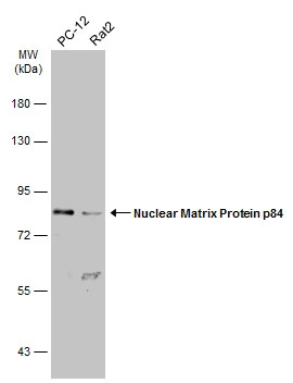 Various whole cell extracts (30 μg) were separated by 7.5% SDS-PAGE, and the membrane was blotted with Nuclear Matrix Protein p84 antibody [C1C3] (GTX102919) diluted at 1:1000. The HRP-conjugated anti-rabbit IgG antibody (GTX213110-01) was used to detect the primary antibody.