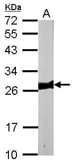Sample (50 ug of whole cell lysate) A: mouse heart 12% SDS PAGE GTX102930 diluted at 1:10000 Sample (50 ug of whole cell lysate) A: mouse heart 12% SDS PAGE GTX102930 diluted at 1:10000