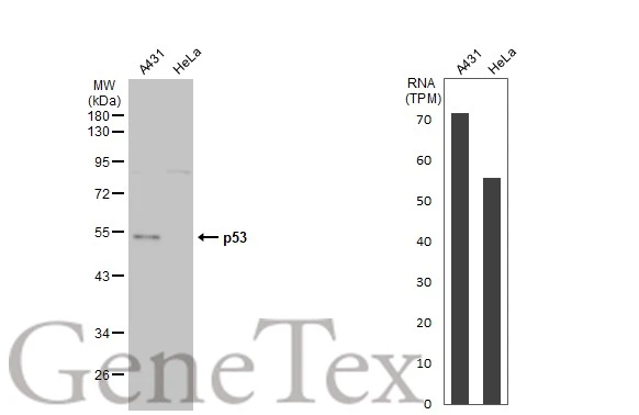 Anti-p53 antibody (GTX102965) | GeneTex