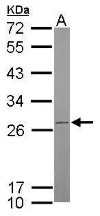 Sample (50 μg of whole cell lysate) A: mouse brain 12% SDS PAGE GTX102980 diluted at 1:500 The HRP-conjugated anti-rabbit IgG antibody (GTX213110-01) was used to detect the primary antibody.