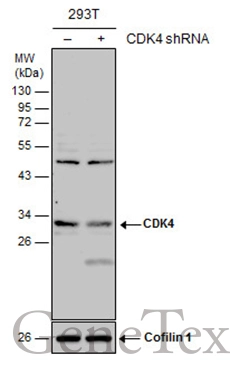 Non-transfected (–) and transfected (+) 293T whole cell extracts (30 μg) were separated by 12% SDS-PAGE, and the membrane was blotted with CDK4 antibody (GTX102993) diluted at 1:1000. The HRP-conjugated anti-rabbit IgG antibody (GTX213110-01) was used to detect the primary antibody.