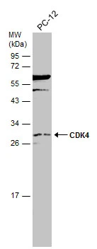 Whole cell extract (30 μg) was separated by 12% SDS-PAGE, and the membrane was blotted with CDK4 antibody (GTX102993) diluted at 1:500. The HRP-conjugated anti-rabbit IgG antibody (GTX213110-01) was used to detect the primary antibody.