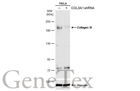 Non-transfected (–) and transfected (+) HeLa whole cell extracts (30 μg) were separated by 5% SDS-PAGE, and the membrane was blotted with Collagen III antibody [C2C3], C-term (GTX102997) diluted at 1:2000. The HRP-conjugated anti-rabbit IgG antibody (GTX213110-01) was used to detect the primary antibody.