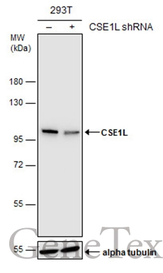 Non-transfected (–) and transfected (+) 293T whole cell extracts (15 μg) were separated by 7.5% SDS-PAGE, and the membrane was blotted with CSE1L antibody (GTX103005) diluted at 1:5000. The HRP-conjugated anti-rabbit IgG antibody (GTX213110-01) was used to detect the primary antibody.