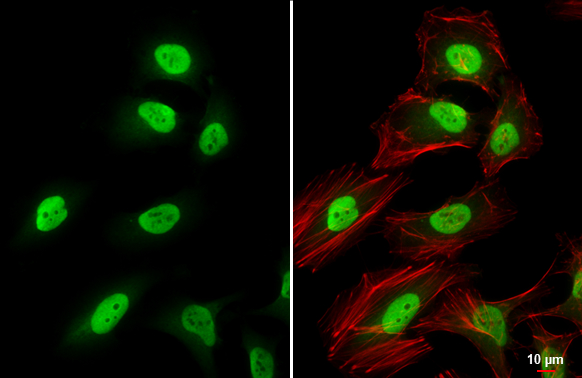 CSE1L antibody detects CSE1L protein at nucleus by immunofluorescent analysis. Sample: HeLa cells were fixed in 4% paraformaldehyde at RT for 15 min. Green: CSE1L stained by CSE1L antibody (GTX103005) diluted at 1:1500. Red: phalloidin, a cytoskeleton marker, diluted at 1:200. Scale bar= 10 μm.
