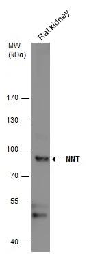 Rat tissue extract (50 μg) was separated by 7.5% SDS-PAGE, and the membrane was blotted with NNT antibody (GTX103015) diluted at 1:1000. The HRP-conjugated anti-rabbit IgG antibody (GTX213110-01) was used to detect the primary antibody.