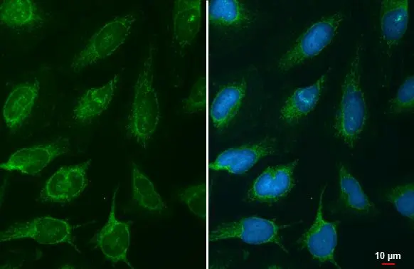 NNT antibody detects NNT protein at mitochondria by immunofluorescent analysis. Sample: HeLa cells were fixed in ice-cold MeOH for 5 min. Green: NNT stained by NNT antibody (GTX103015) diluted at 1:500.