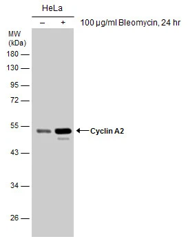 Untreated (–) and treated (+) HeLa whole cell extracts (30 μg) were separated by 10% SDS-PAGE, and the membrane was blotted with Cyclin A2 antibody (GTX103042) diluted at 1:1000. The HRP-conjugated anti-rabbit IgG antibody (GTX213110-01) was used to detect the primary antibody.