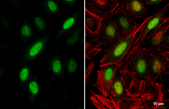 Cyclin A2 antibody detects Cyclin A2 protein at nucleus by immunofluorescent analysis. Sample: HeLa cells were fixed in 4% paraformaldehyde at RT for 15 min. Green: Cyclin A2 stained by Cyclin A2 antibody (GTX103042) diluted at 1:500. Red: phalloidin, a cytoskeleton marker, diluted at 1:100. Scale bar= 10 μm.