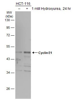 Untreated (–) and treated (+) HCT-116 whole cell extracts (30 μg) were separated by 10% SDS-PAGE, and the membrane was blotted with Cyclin E1 antibody (GTX103045) diluted at 1:500. The HRP-conjugated anti-rabbit IgG antibody (GTX213110-01) was used to detect the primary antibody.