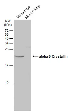 Various tissue extracts (50 μg) were separated by 15% SDS-PAGE, and the membrane was blotted with alpha B Crystallin antibody (GTX103053) diluted at 1:50000. The HRP-conjugated anti-rabbit IgG antibody (GTX213110-01) was used to detect the primary antibody.