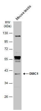 Mouse tissue extract (50 μg) was separated by 10% SDS-PAGE, and the membrane was blotted with DMC1 antibody [N1C1] (GTX103062) diluted at 1:1000. The HRP-conjugated anti-rabbit IgG antibody (GTX213110-01) was used to detect the primary antibody, and the signal was developed with Trident ECL plus-Enhanced.