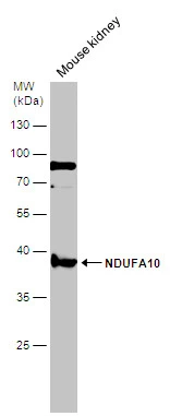 Mouse tissue extract (50 μg) was separated by 10% SDS-PAGE, and the membrane was blotted with NDUFA10 antibody [N1C3] (GTX103093) diluted at 1:500.