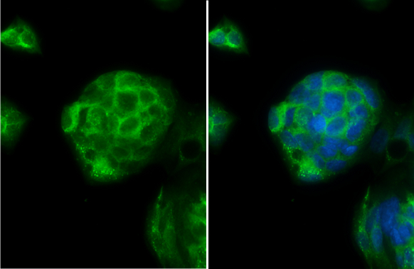Interferon gamma Receptor 1 antibody detects Interferon gamma Receptor 1 protein at cell membrane by immunofluorescent analysis. Sample: HepG2 cells were fixed in 4% paraformaldehyde at RT for 15 min. Green: Interferon gamma Receptor 1 stained by Interferon gamma Receptor 1 antibody (GTX103098) diluted at 1:500. Blue: Fluoroshield with DAPI (GTX30920).