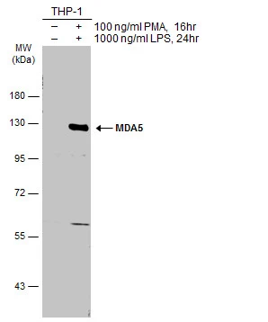 Untreated (–) and treated (+) THP-1 whole cell extracts (30 μg) were separated by 7.5% SDS-PAGE, and the membrane was blotted with MDA5 antibody [N2C1], Internal (GTX103138) diluted at 1:1000. The HRP-conjugated anti-rabbit IgG antibody (GTX213110-01) was used to detect the primary antibody.