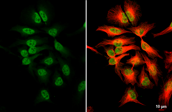 NRF1 antibody detects NRF1 protein at nucleus by immunofluorescent analysis. Sample: HeLa cells were fixed in 4% paraformaldehyde at RT for 15 min. Green: NRF1 stained by NRF1 antibody (GTX103179) diluted at 1:500. Red: alpha Tubulin, a cytoskeleton marker, stained by alpha Tubulin antibody [GT114] (GTX628802) diluted at 1:1000. Scale bar= 10μm.