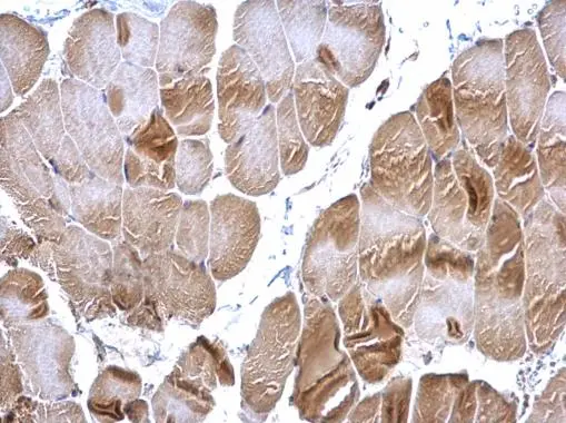 RRM2 antibody [N1C1] detects RRM2 protein at cytoplasm on mouse muscle by immunohistochemical analysis. Sample: Paraffin-embedded mouse muscle. RRM2 antibody [N1C1] (GTX103193) diluted at 1:500. 
 Antigen Retrieval: Trilogy? (EDTA based, pH 8.0) buffer, 15min