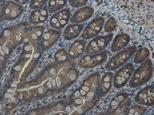 RRM2 antibody [N1C1] detects RRM2 protein at cytoplasm in rat intestine by immunohistochemical analysis. Sample: Paraffin-embedded rat intestine. RRM2 antibody [N1C1] (GTX103193) diluted at 1:500. 
 Antigen Retrieval: Citrate buffer, pH 6.0, 15 min