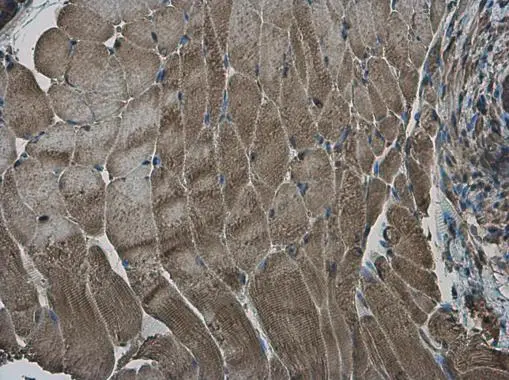 RRM2 antibody [N1C1] detects RRM2 protein at cytoplasm in mouse prostate by immunohistochemical analysis. Sample: Paraffin-embedded mouse muscle. RRM2 antibody [N1C1] (GTX103193) diluted at 1:500. 
 Antigen Retrieval: Citrate buffer, pH 6.0, 15 min