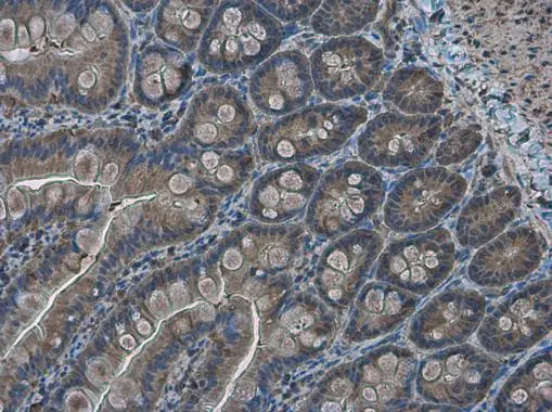 RRM2 antibody [N1C1] detects RRM2 protein at cytoplasm in rat intestine by immunohistochemical analysis. Sample: Paraffin-embedded rat intestine. RRM2 antibody [N1C1] (GTX103193) diluted at 1:500. 
 Antigen Retrieval: Citrate buffer, pH 6.0, 15 min