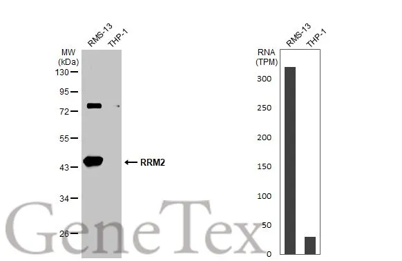 Various whole cell extracts (30 μg) were separated by 10% SDS-PAGE, and the membrane was blotted with RRM2 antibody [N1C1] (GTX103193) diluted at 1:1000. The HRP-conjugated anti-rabbit IgG antibody (GTX213110-01) was used to detect the primary antibody. Corresponding RNA expression data for the same cell lines are based on Human Protein Atlas program.