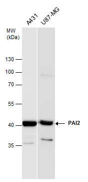 PAI2 antibody detects PAI2 protein by western blot analysis. Various whole cell extracts (30 μg) were separated by 10% SDS-PAGE, and the membrane was blotted with PAI2 antibody (GTX103194) diluted at a dilution of 1:1000. The HRP-conjugated anti-rabbit IgG antibody (GTX213110-01) was used to detect the primary antibody.