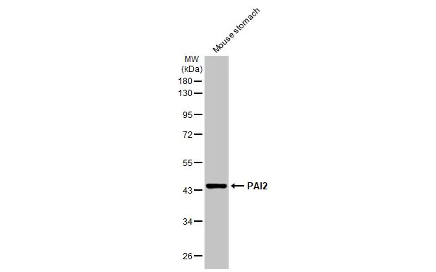 Mouse tissue extract (50 μg) was separated by 10% SDS-PAGE, and the membrane was blotted with PAI2 antibody (GTX103194) diluted at 1:1000. The HRP-conjugated anti-rabbit IgG antibody (GTX213110-01) was used to detect the primary antibody, and the signal was developed with Trident ECL plus-Enhanced.