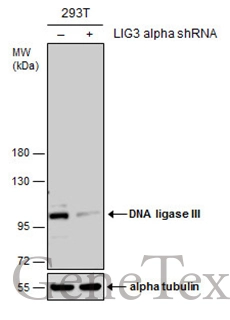 Non-transfected (–) and transfected (+) 293T whole cell extracts (30 μg) were separated by 7.5% SDS-PAGE, and the membrane was blotted with DNA ligase III antibody [C2C3], C-term (GTX103197) diluted at 1:500.