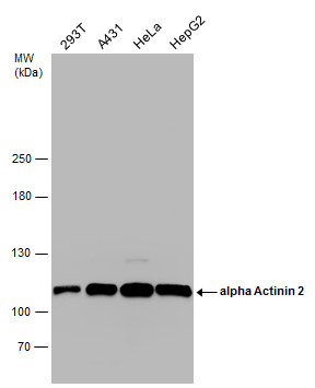 Various whole cell extracts (30 ug) were separated by 5% SDS-PAGE,and the membrane was blotted with alpha Actinin 2 antibody [N1N3] (GTX103219) diluted at 1:1000.