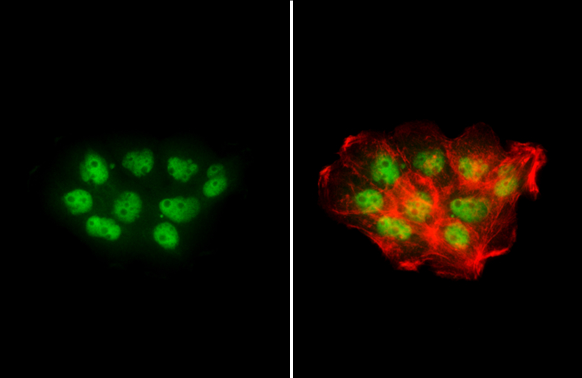 NBS1 antibody detects NBS1 protein at nucleus by immunofluorescent analysis. Sample: A431 cells were fixed in 4% paraformaldehyde at RT for 15 min. Green: NBS1 stained by NBS1 antibody (GTX103229) diluted at 1:500. Red: phalloidin, a cytoskeleton marker, diluted at 1:200.