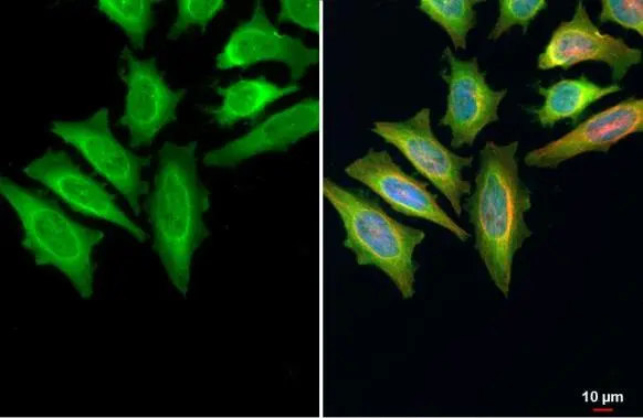 Thymidylate synthase antibody detects Thymidylate synthase protein at cytoplasm by immunofluorescent analysis. Sample: HeLa cells were fixed in 4% paraformaldehyde at RT for 15 min. Green: Thymidylate synthase stained by Thymidylate synthase antibody (GTX103235) diluted at 1:500. Red: alpha Tubulin, a cytoskeleton marker, stained by alpha Tubulin antibody [GT114] (GTX628802) diluted at 1:1000. Blue: Fluoroshield with DAPI (GTX30920).