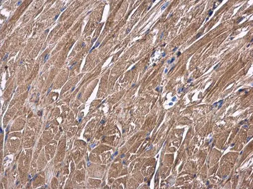 USP4 antibody detects USP4 protein at cytoplasm in mouse muscle by immunohistochemical analysis. Sample: Paraffin-embedded mouse muscle. USP4 antibody (GTX103237) diluted at 1:500. 
 Antigen Retrieval: Citrate buffer, pH 6.0, 15 min