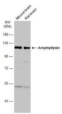 Various tissue extracts (50 μg) were separated by 7.5% SDS-PAGE, and the membrane was blotted with Amphiphysin antibody [N1N2], N-term (GTX103247) diluted at 1:1000. The HRP-conjugated anti-rabbit IgG antibody (GTX213110-01) was used to detect the primary antibody.