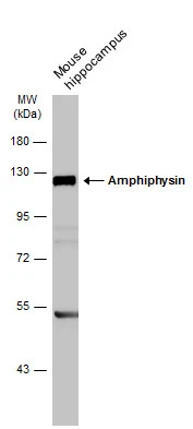 Mouse tissue extract (50 μg) was separated by 7.5% SDS-PAGE, and the membrane was blotted with Amphiphysin antibody [N1N2], N-term (GTX103247) diluted at 1:1000. The HRP-conjugated anti-rabbit IgG antibody (GTX213110-01) was used to detect the primary antibody.