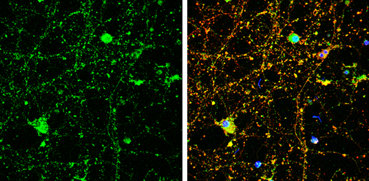 Amphiphysin antibody [N1N2], N-term detects Amphiphysin protein by immunofluorescent analysis. Sample: DIV9 rat E18 primary cortical neuron cells were fixed in 4% paraformaldehyde at RT for 15 min. Green: Amphiphysin stained by Amphiphysin antibody [N1N2], N-term (GTX103247) diluted at 1:500. Red: beta Tubulin 3/ Tuj1, stained by beta Tubulin 3/ Tuj1 antibody [GT1338] (GTX631831) diluted at 1:500. Blue: Fluoroshield with DAPI (GTX30920).