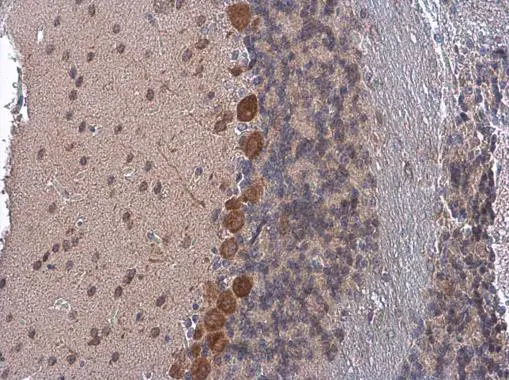 COPD antibody detects COPD protein at cytoplasm by immunohistochemical analysis. Sample: Paraffin-embedded mouse brain. COPD stained by COPD antibody (GTX103252) diluted at 1:500.
 Antigen Retrieval: Citrate buffer, pH 6.0, 10 min