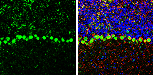 COPD antibody detects COPD protein by immunohistochemical analysis. Sample: Frozen-sectioned mouse mouse cerebellum. Green: COPD stained by COPD antibody (GTX103252) diluted at 1:250. Red: NF-H, stained by NF-H antibody [GT114] (GTX634289) diluted at 1:500. Blue: Fluoroshield with DAPI (GTX30920).
 Antigen Retrieval: Citrate buffer, pH 6.0, 10 min