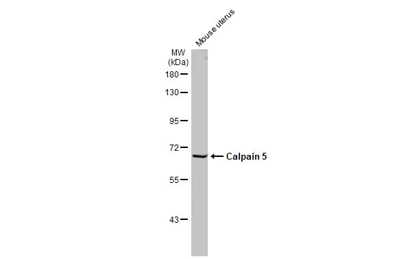 Mouse tissue extract (50 μg) was separated by 7.5% SDS-PAGE, and the membrane was blotted with Calpain 5 antibody [N1C1] (GTX103264) diluted at 1:1000. The HRP-conjugated anti-rabbit IgG antibody (GTX213110-01) was used to detect the primary antibody.