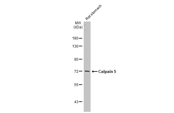 Rat tissue extract (50 μg) was separated by 7.5% SDS-PAGE, and the membrane was blotted with Calpain 5 antibody [N1C1] (GTX103264) diluted at 1:1000. The HRP-conjugated anti-rabbit IgG antibody (GTX213110-01) was used to detect the primary antibody.