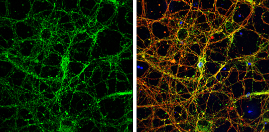 Anti-Homer1 antibody (GTX103278) | GeneTex Anti-Homer1 antibody (GTX103278) | GeneTex