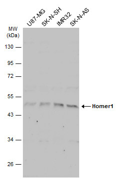 Immunohistochemical analysis of paraffin-embedded human ovarian cancer,using HOMER1(GTX103278) antibody at 1:100 dilution.